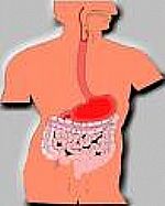 COLON IRRITABLE